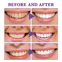 V34 Tooth Cleaning Mousse – Whitening & Gum Care Foam for a Brighter Smile