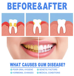 Teeth Repair Gel – Gum Soothing & Oral Care Gel with Hyaluronic Acid & Aloe